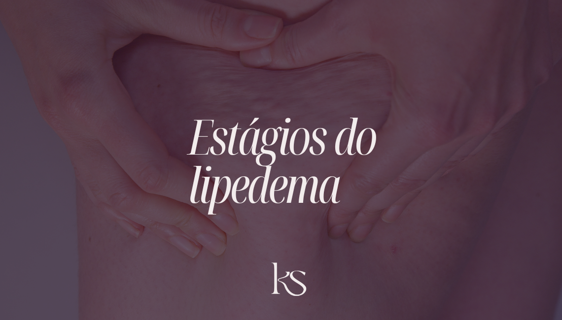 Estágios do lipedema: o que muda em cada fase e como a nutrição pode ajudar
